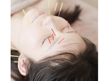 ハリシエール(Hariciere)/【人気No.1】美容鍼