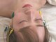 天使のうたたねの写真/【美容鍼】リフトUP/眼精疲労/顔筋のこわばり/むくみ【鍼ケア】自律神経の乱れ/頭痛/首肩こり/疲労解消に◎