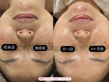 グラン ジュテ/定期的継続的なケアを