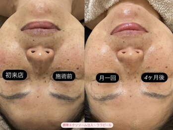 グラン ジュテ/定期的継続的なケアを