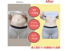 キセキのピラティス 銀座店の雰囲気（お腹ぽっこり・太もも、背中などの気になるパーツにも効果的）