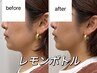 福井初☆最先端脂肪分解☆【レモンボトル】二重顎/頬/目の下のたるみケアに♪