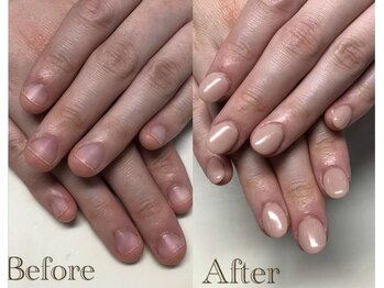 ティアラネイル 宇都宮/深爪矯正