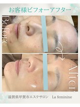 ラ フェミニン(La feminine)/ララピール＊40代モニター様