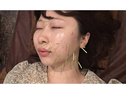 ロミハリ(LomiHari)の写真