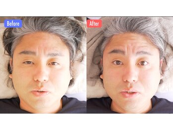 ルーツ 麻布十番店(R∞ts)の写真/施術経験豊富なスタッフによるこだわり抜いた小顔/整体手技で圧倒的な効果実感!「個体特性」を見極め施術◎