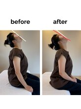 フィデル(fidele)/首の柔らかさが回復【表参道】