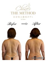 アンベリール(Embellir)/チノザメソッド