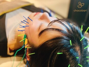 チョコバリ 渋谷店(chocobari)の写真/【小顔リフト美容鍼◆初回2980円】国家資格の高技術スタッフが対応♪初めての方や速効効果を実感したい方に