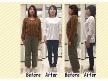 高槻てんじんまち整体院/－10kg産後ダイエット成功