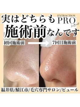 ピュール 鯖江店(PUR)/毛穴サロン/毛穴ケア/毛穴洗浄