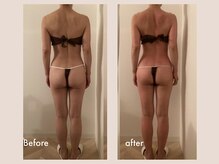 レモン(Lemon)/ビフォーアフター