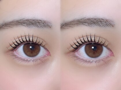 ルル(RuRu)の写真