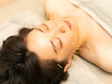 アスカル鍼灸整骨院の雰囲気(当院イチオシメニューの美容鍼♪効果は直ぐに体感いただけます!)