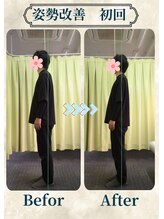 アミーゴ整体院/ビフォーアフター