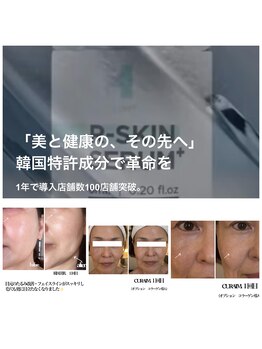 エンドット(EN.)の写真/急遽のエイジングケアで若さを取り戻す！