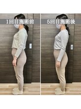 シェア 人形町店(Chare)/【小顔・骨盤矯正・О脚・整体】