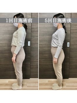 シェア 人形町店(Chare)/【小顔・骨盤矯正・О脚・整体】