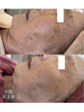 アンク(Ankh)/何歳からスタートしても遅くない