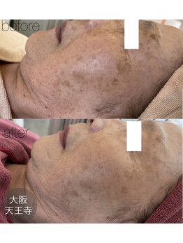 アンク(Ankh)/何歳からスタートしても遅くない