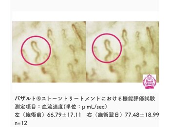 ウェルフィット/毛細血管に関するエビデンス