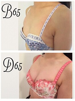 美人バスト 千葉店/バストアップ