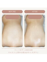 リンパ専門店 ファリンソ/リンパマッサージのBefore&After