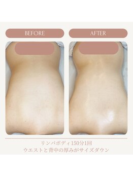 リンパ専門店 ファリンソ/リンパマッサージのBefore&After