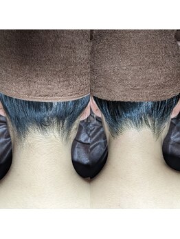 ムーン 横浜(MOON)/【うなじ】