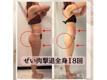 ハナ チュチュ(Hana chuchu)の雰囲気（セル脂肪撲滅 12回★360°美人♪後ろ姿まで無敵へダイエットNo.1）