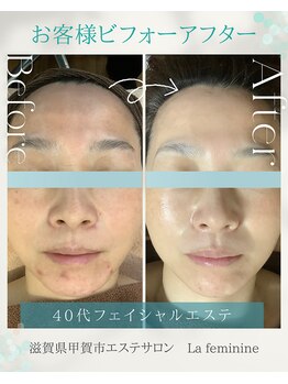 ラ フェミニン(La feminine)/韓国肌管理＊40代モニター様