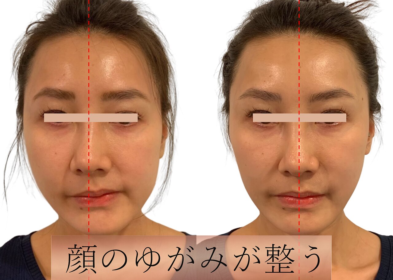 小顔製作所 心斎橋院｜ホットペッパービューティー