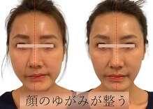 小顔製作所 心斎橋院