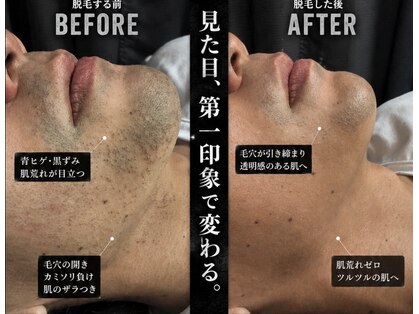 エステサロン オパール(OPALE)の写真
