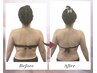 【背中、二の腕】美容整体×ウィンバック×上半身リンパ 120分