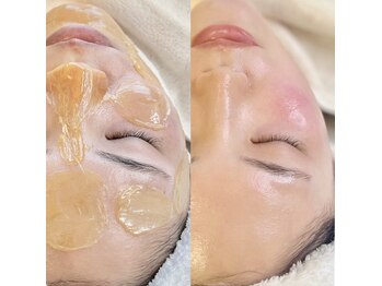 サロンブランシュ(salon BLANCHE)/速攻艶肌！土台を整える艶肌WAX