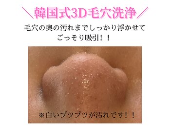 ダイヤモンド リーエンダ(Diamond leende)/韓国式3D毛穴洗浄