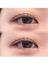 フルール(Fleur)/メーテルロッド