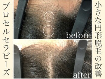 サロン アール(salon AR)/