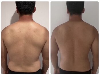 ディオ(Dio)/引き締まった後ろ姿が手に入る