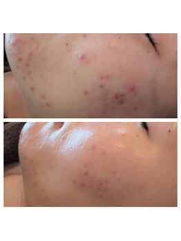 シロエルヴィ(SILOE)/未来の自分が楽しみになる