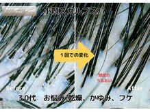 ポノ 甲府本店(pono)/小顔スカルプスパ