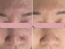 サロン ビュー(salon view)の雰囲気（毛穴の引き締め・トーンUP！腸内環境が変わると健康/美肌に☆）