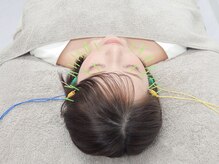 小顔美容鍼灸院HARIKA横浜店【美容鍼×小顔矯正×ブライダル】【4/1NEWOPEN（予定）】/ブライダル前に美容鍼×小顔矯正