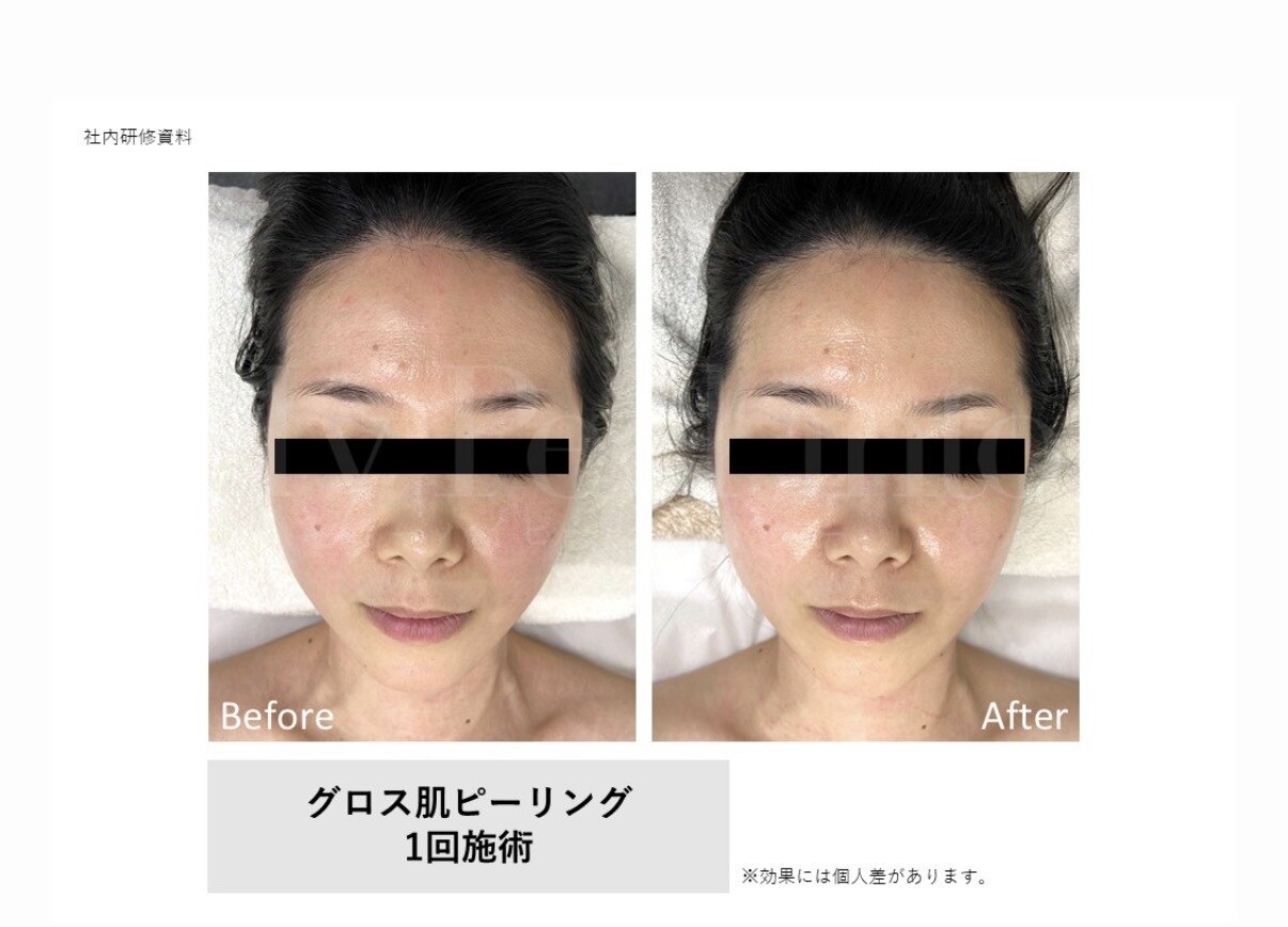 ティンク 心斎橋(Tink)｜ホットペッパービューティー
