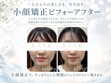 美人ヶ丘 長野店