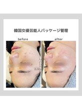 ポムハヌル(pom.haneul)/韓国肌管理室