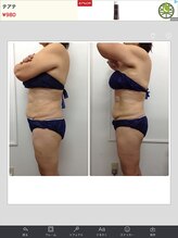 健康痩身研究所 名和店/ビフォーアフター