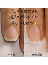 リリー(Lilly)/美爪育成