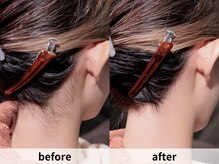 アルムボーテ 代官山 恵比寿(ARUIM Beaute)/うなじビフォーアフター